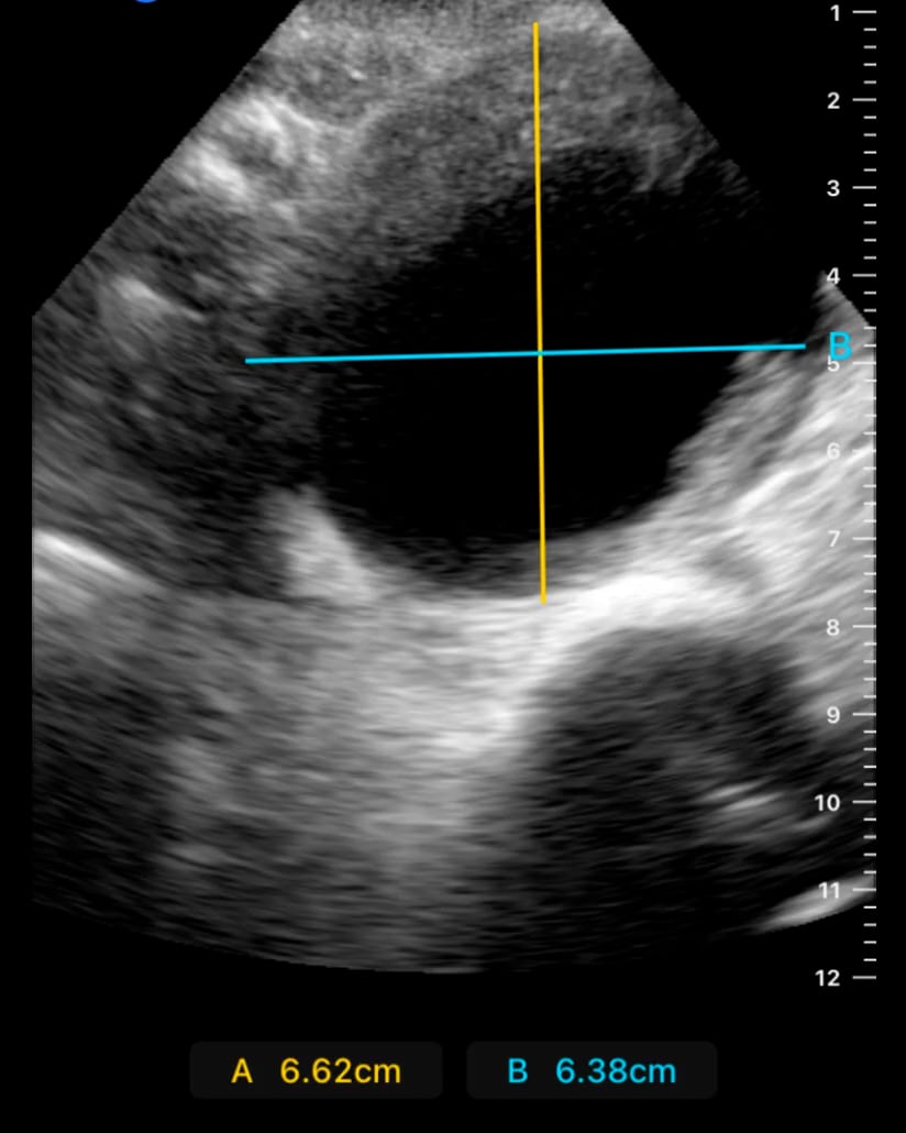Aaa Pathology - Video