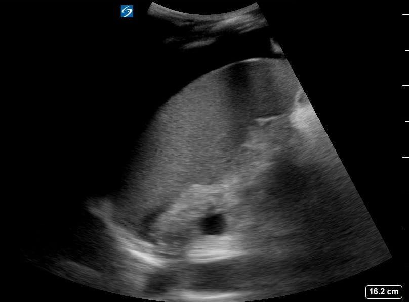 Luq Free Fluid8 - Video