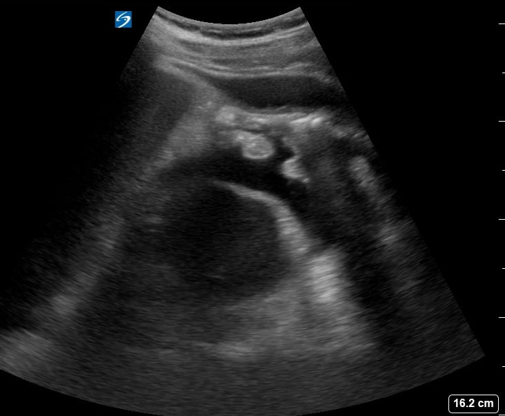 Ruq Free Fluid7 - Video