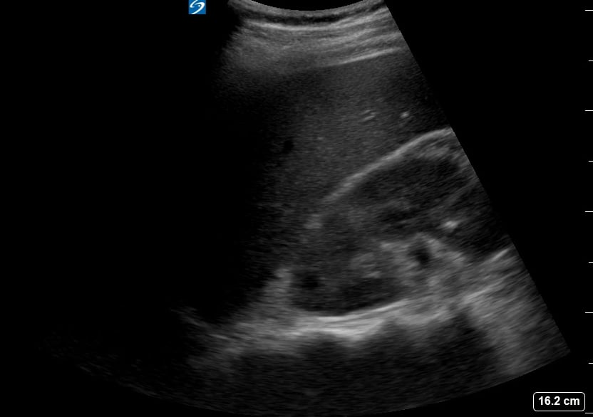 Ruq (-) Free Fluid13 - Video