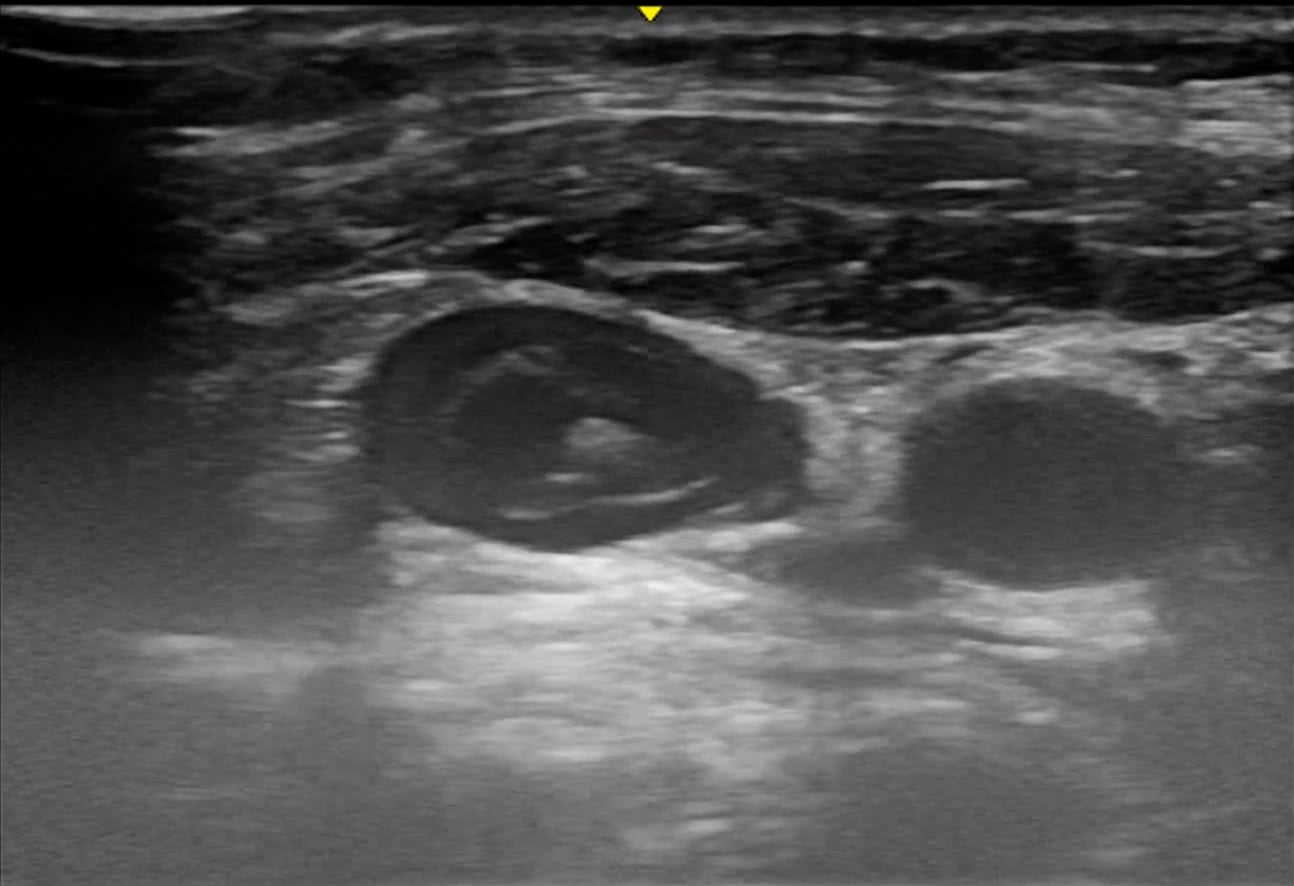 objects: DVT - Video