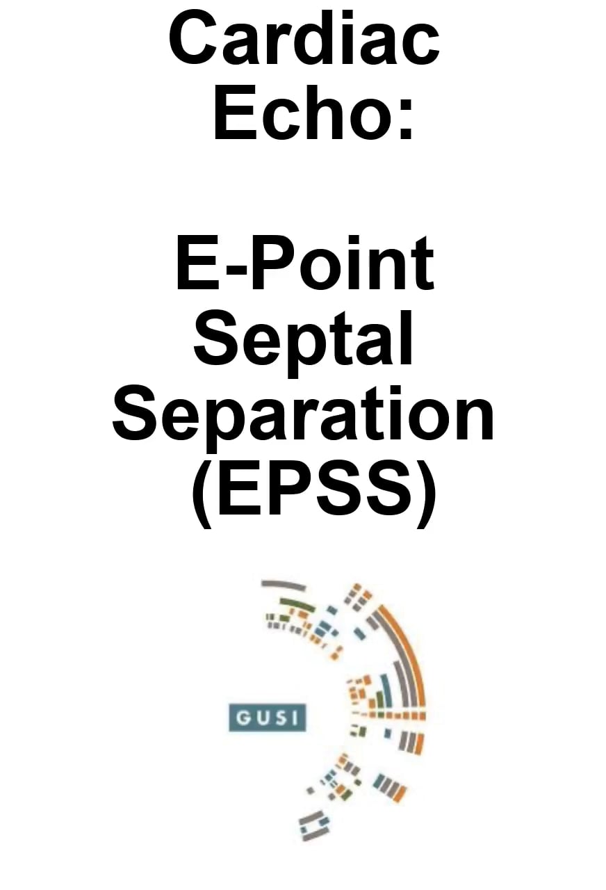 Epss Overview - Video