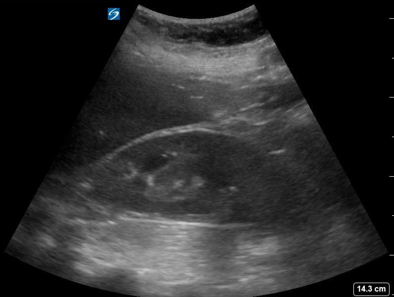 Ruq (-) Free Fluid3 - Video