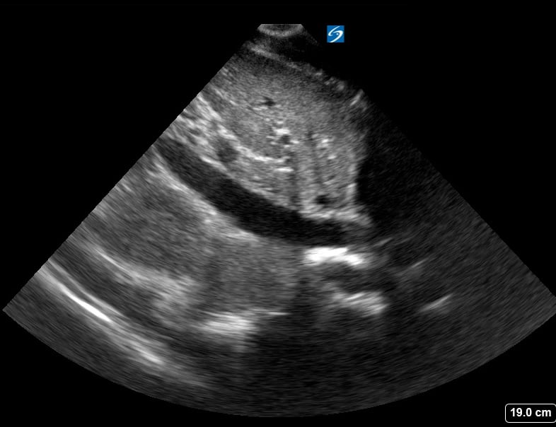 Normal Ivc12 - Video