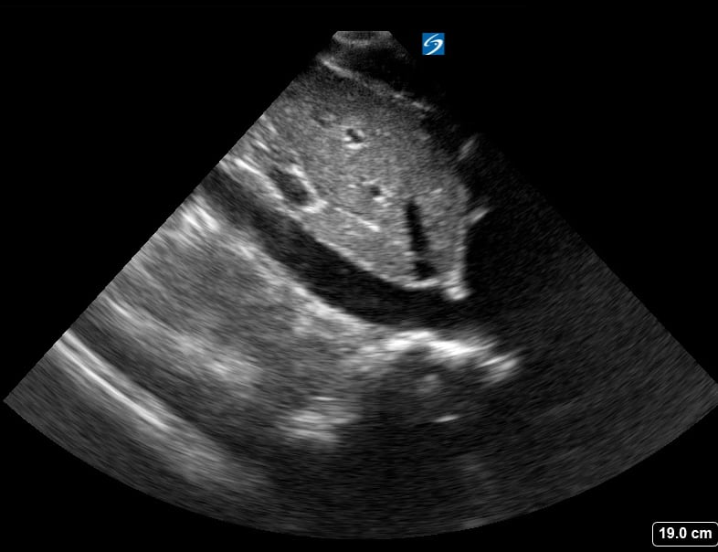 Normal Ivc11 - Video