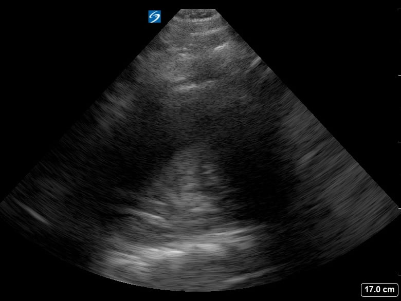 Consolidation3 - Video