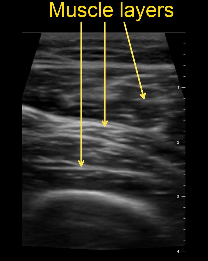Soft Tissue Anatomy - Video